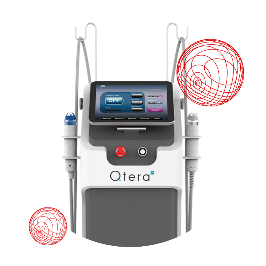 Qtera Rf Mikronakuwanie 1